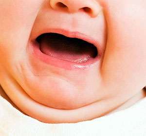 Colic