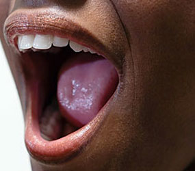 Bad Breath
