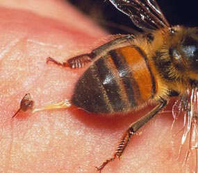 Bee Stings